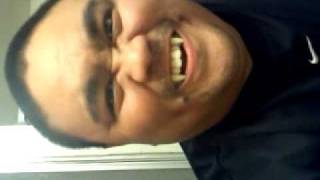My True Blood fangs!! Real Retractable Fangs!!!
