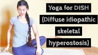 Yoga for DISH (Diffuse idiopathic skeletal hyperostosis) l In Hindi l Archie's Yoga