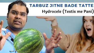 Andkosh me pani | Hydrocele Full Information (Hindi)