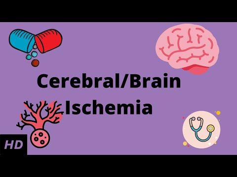 Cerebral/Brain Ischemia, Causes, Signs and Symptoms, Diagnosis and Treatment.