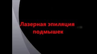 Лазерная эпиляция подмышек Киев. Лазерал Шер.(, 2016-01-29T14:09:37.000Z)