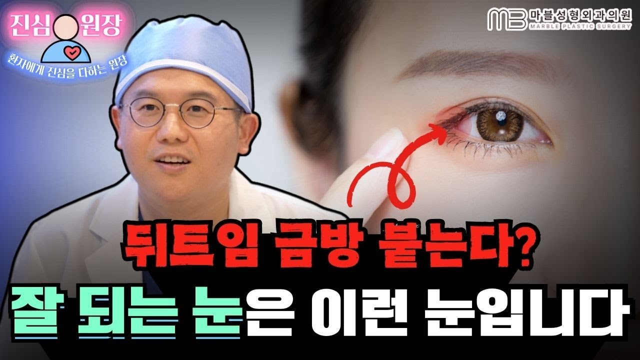 [성형외과 전문의 Q&A]  뒤트임성형, 붙는다고 누가 그래요? 잘되는 눈은 따로 있습니다