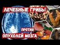 ЛЕЧЕБНЫЕ ГРИБЫ против опухолей мозга. Глиобластома. Астроцитома. Каков эффект?