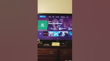 Xbox one Issues with home button