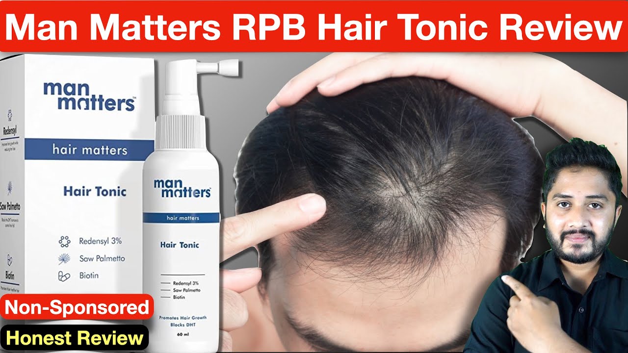 Man Matters RPB Hair Tonic Review : Usage, Benefits and Side Effects. -  YouTube