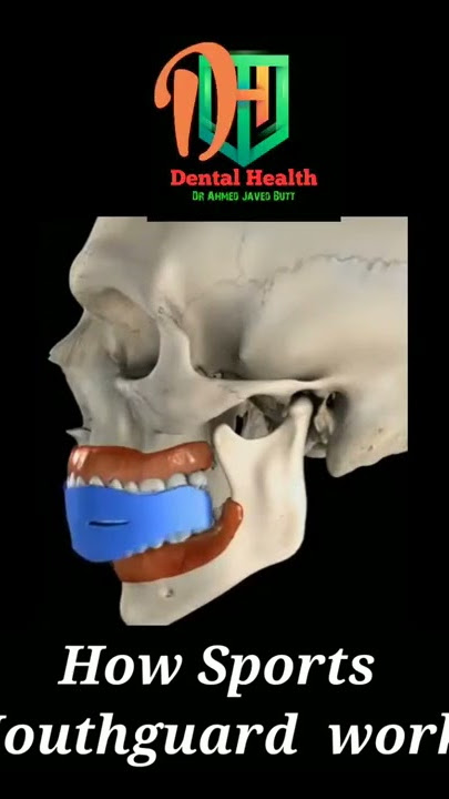 How mouth guard works