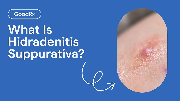 Hidradenitis Suppurativa, Explained: Symptoms, Causes, and Complications | GoodRx