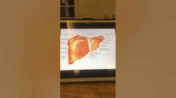 Giải phẫu Gan và cuống gan - PGS.TS Ngô Xuân Khoa