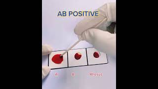 Blood group test /   #shorts screenshot 5