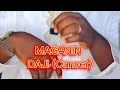 Maganin Daji Herbal Medicine For Cancer 