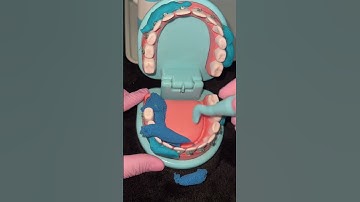 Brush & floss daily to avoid this! Comment name age procedure! #fok #asmr