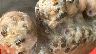 Philip’s right leg - ROTTEN, SCALES AND PUS - watch full videos @riseupsociety.net