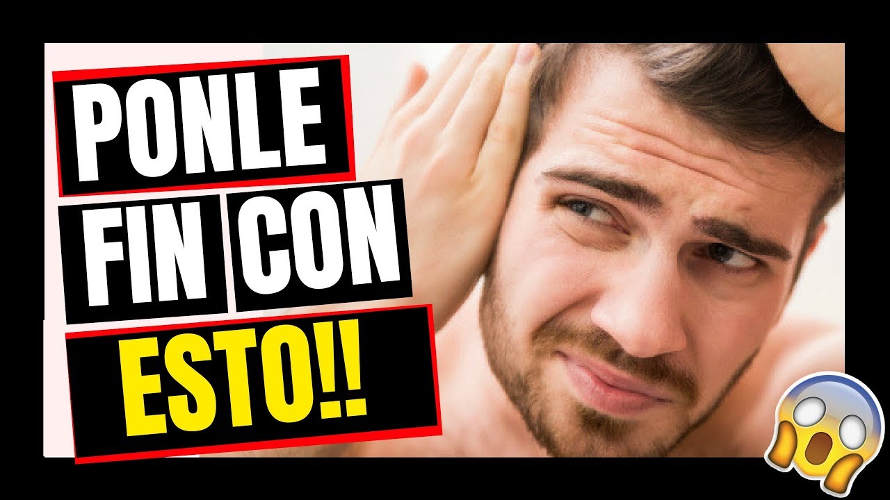 Como PREVENIR la CAIDA del CABELLO en HOMBRES remedios
