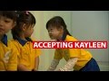 Kayleen: Accepting A Child With Down Syndrome