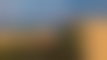 Robotic Right Middle Lobectomy