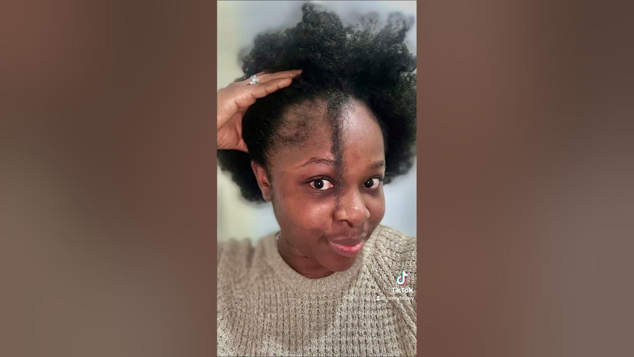  What my postpartum hair loss looks like #newmom #postpartum #hairloss # ...
