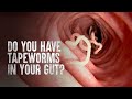 How to survive tapeworms warning distressing footage