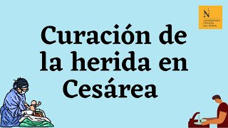 Curacion de la Herida Cesarea Carrera de Obstetricia