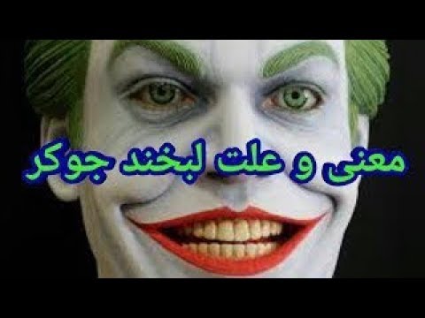 تصویری: لبخند جوکر: طرفداران از یانا کوشکینا به دلیل پلاستیک ناموفق انتقاد می کنند