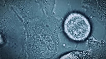 Dell AI Factory with NVIDIA: Powering Drug Discovery