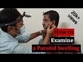 Clinical examination of a parotid gland swelling step by step demonstration