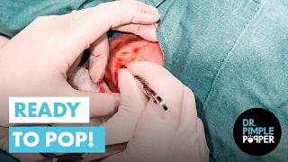A Surprise Inside This Neck!