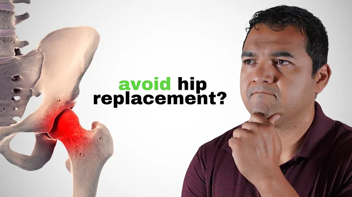 Can You Actually Cure Hip Arthritis and Avoid Replacement Surgery? - DayDayNews
