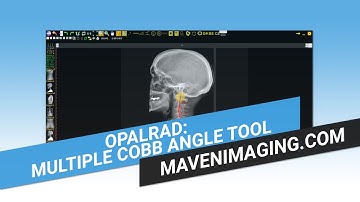 20 Multiple Cobb Angles Tool