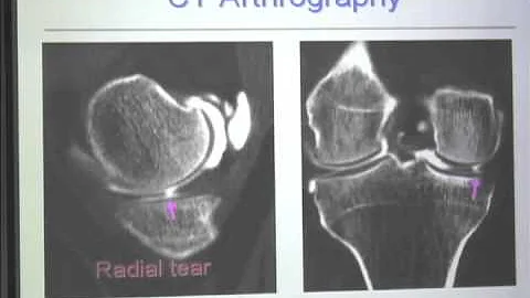 MRI of the Knee for the Practicing Orthopaedic Sur...