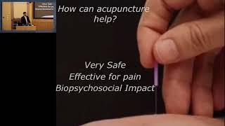 Acupuncture for Chronic Pain in the Vermont Medicaid Population