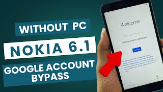 How to Bypass Google Account on Nokia 6.1 Fast and Easy!