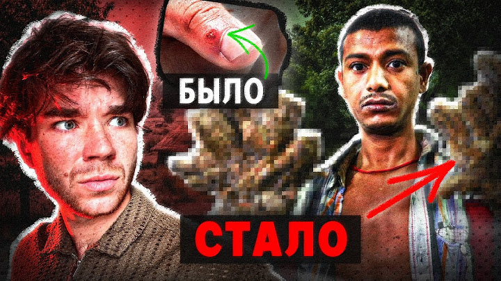 The VIRUS that did THIS to him. Why? | Reflections.