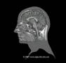 3D MRI Human Brain Anatomy