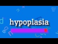 How to say "hypoplasia"! (High Quality Voices)