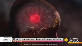 How to prevent and treat migraine attacks