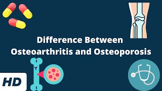 Difference Between Osteoarthritis and Osteoporosis