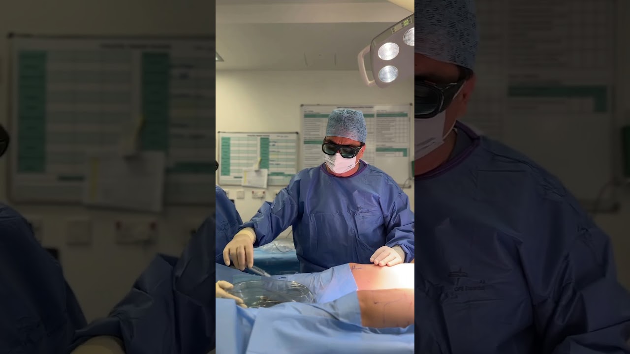 Cellulaze laser can reduce cellulite significantly and permanently.