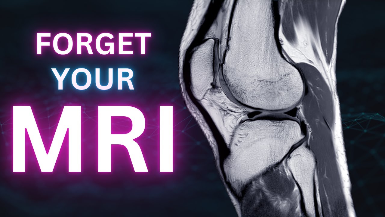 Forget Your MRI
