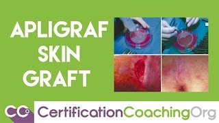 What is Apligraf - Medical Coding for Apligraf Skin Graft Procedures