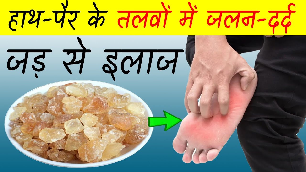 पानी में घोलकर पी लो, हाथ पैर के तलवों में दर्द, जलन जड़ से खत्म हो
