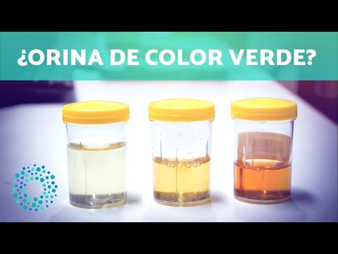 Video: ¿Por qué mi orina es verde luminosa?