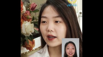 LỘT XÁC THÀNH HOT GIRL SAU NIỀNG RĂNG CỦA BẠN LỄ TÂN XINH ĐẸP 😍