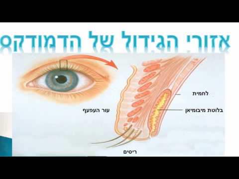 טפיל הדמודקס (הנמצא על כולנו) - יכול לגרום לעיניים יבשות ו בלפריטיס