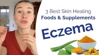 Eczema Treatment - The 3 Best Foods & Supplements to Boost Your Skin Healing