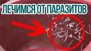 Как избавиться паразитов в организме домашних условиях