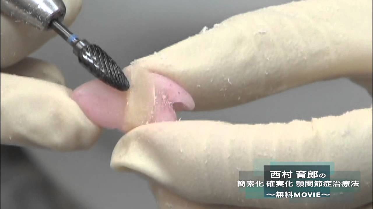 簡素化 確実化 顎関節症治療法 | 医療情報研究所 DVD教材ストア
