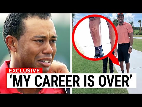 Tiger Woods Fans Are WORRIED After What They Saw On His Leg..