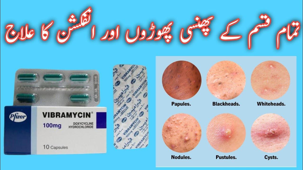 Vibramycin Doxycycline Hyclate 100mg Uses Benifits And Side Effects In vibramycin-doxycycline-hyclate-100mg-uses-benifits-and-side-effects-in