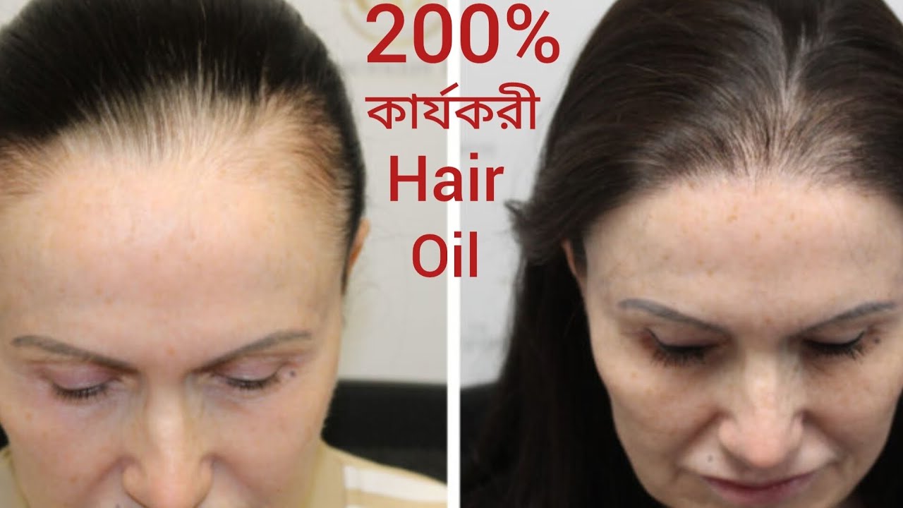 Healthy hair oil এই তেল ব্যবহারে একটাও চুল উঠবে না কালো হবে মাথায় নতুন চুল গজাবে এবং আঁশ মোটা হবে ।