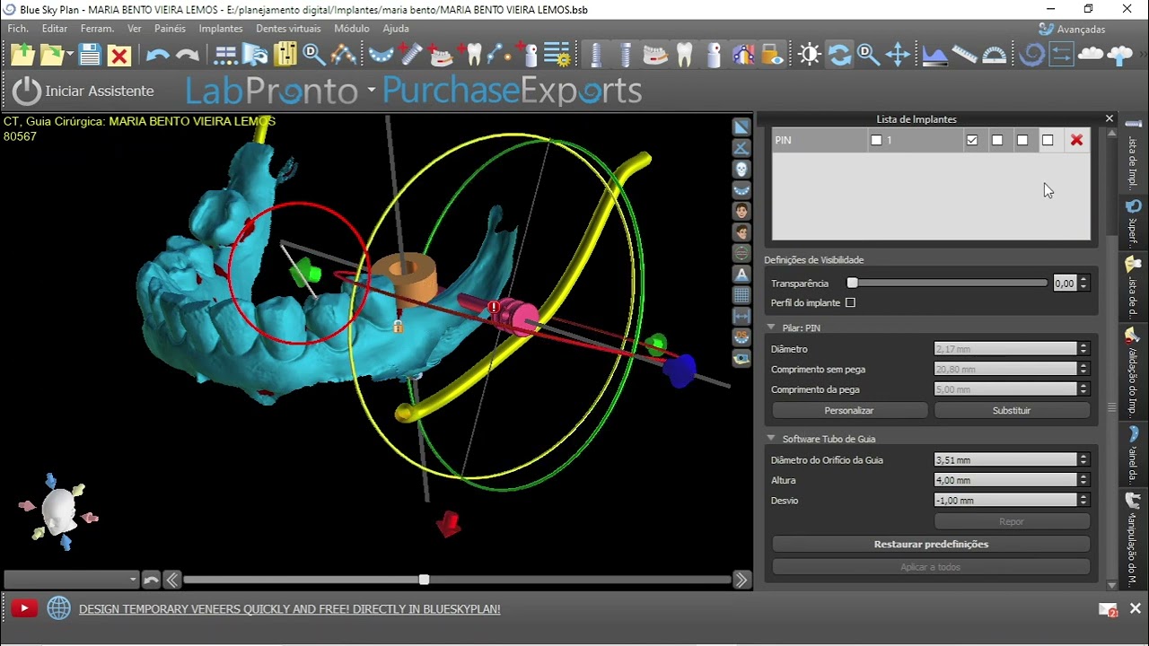 como fazer guias dento muco suportadas no blueskybio
